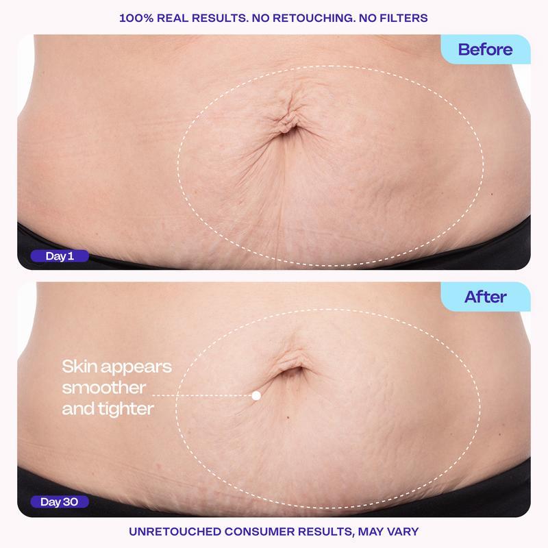 Tighten & Smooth Belly Firming Cream - Targeted Skin Support for Women