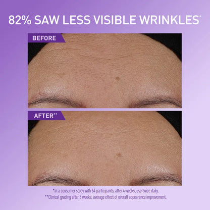Anti-Aging Serum with 5 Active Ingredients and Ceramides for Hydrated, Plumper Skin