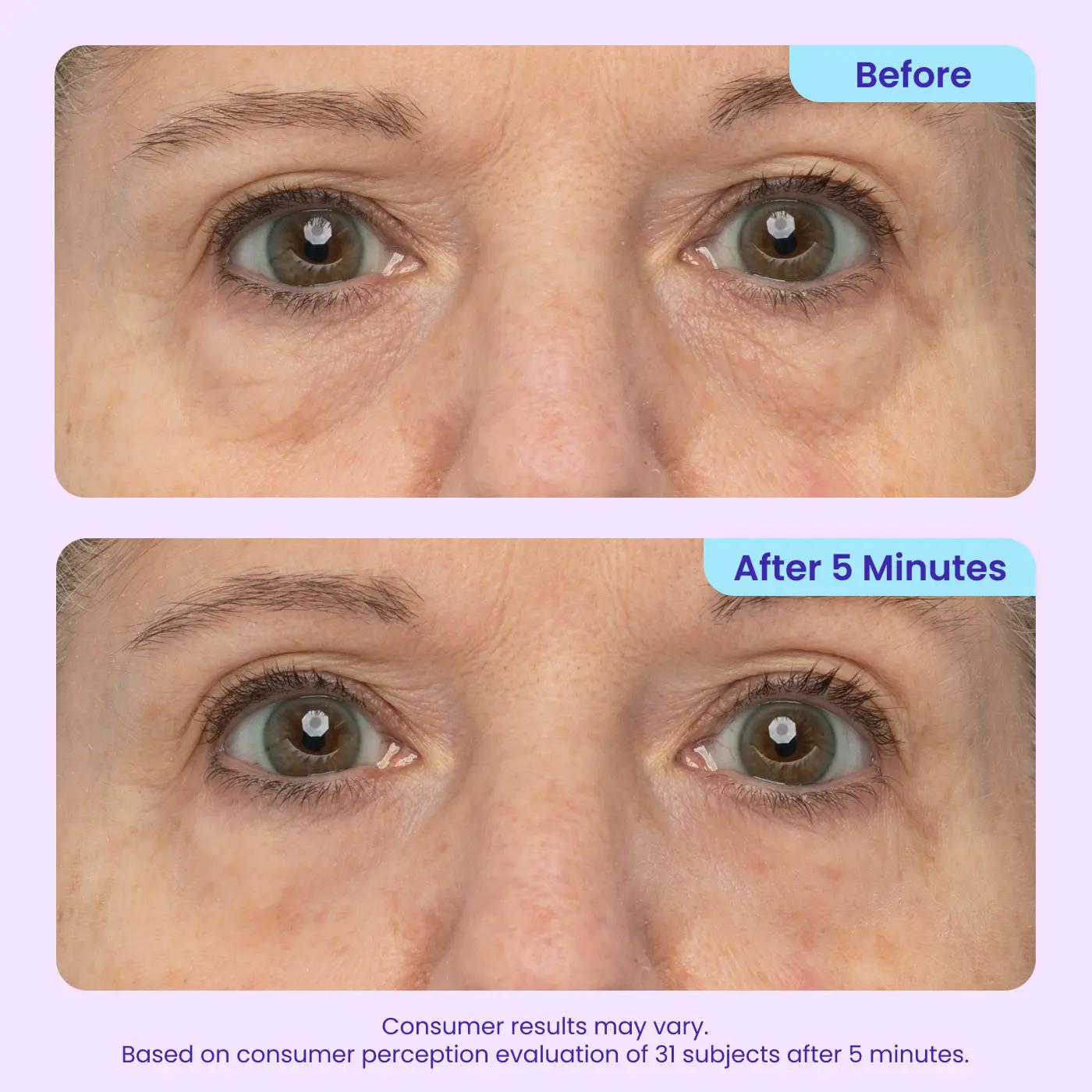 Instant Lift Eye Gel for Puffiness, Bags, Wrinkles, and Dark Circles - Anti-Aging Skin Care for Men & Women