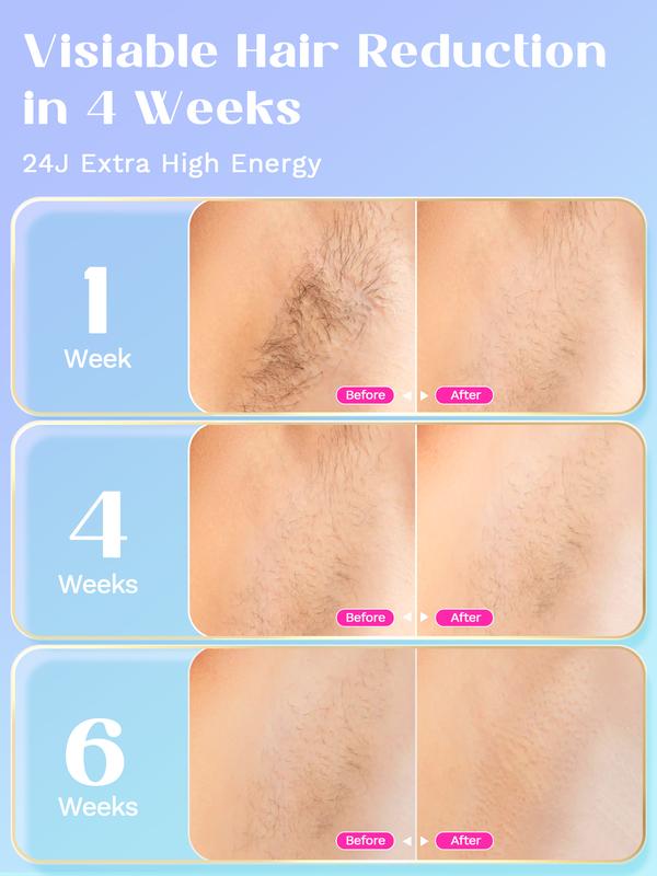 Professional IPL Hair Removal Device with Ice Cooling Function and 24J High Energy