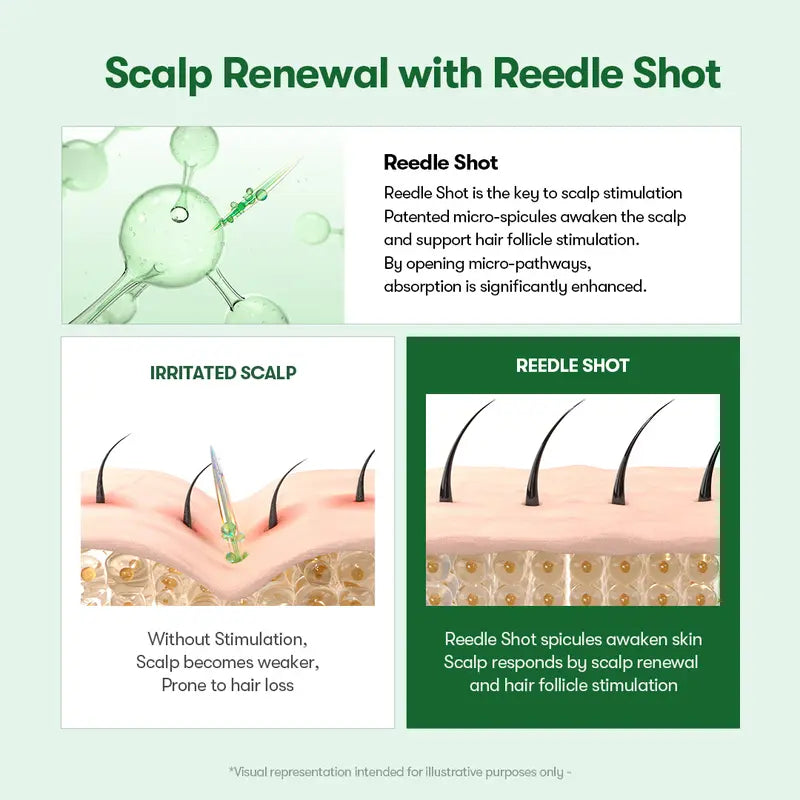 PDRN Microneedling Hair Brush Serum for Scalp Care and Hair Thickening, Large-Capacity Daily Root Treatment