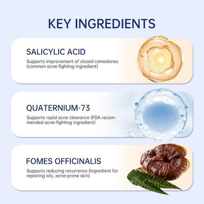 Salicylic Acid Anti-Acne Lotion - Quick Relief for Pimples and Oil Control for Sensitive Skin, 10ml
