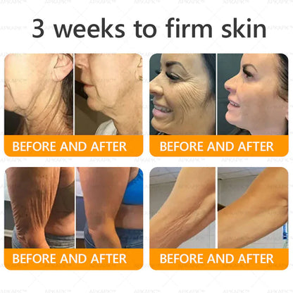 Bee Venom Comprehensive Anti-Aging Cream - Advanced Skin Firming and Wrinkle Repair
