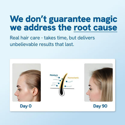 Advanced Hair Growth Roll-On Serum with 3% Rosemary and Potent Growth Complexes - Precision Scalp Applicator