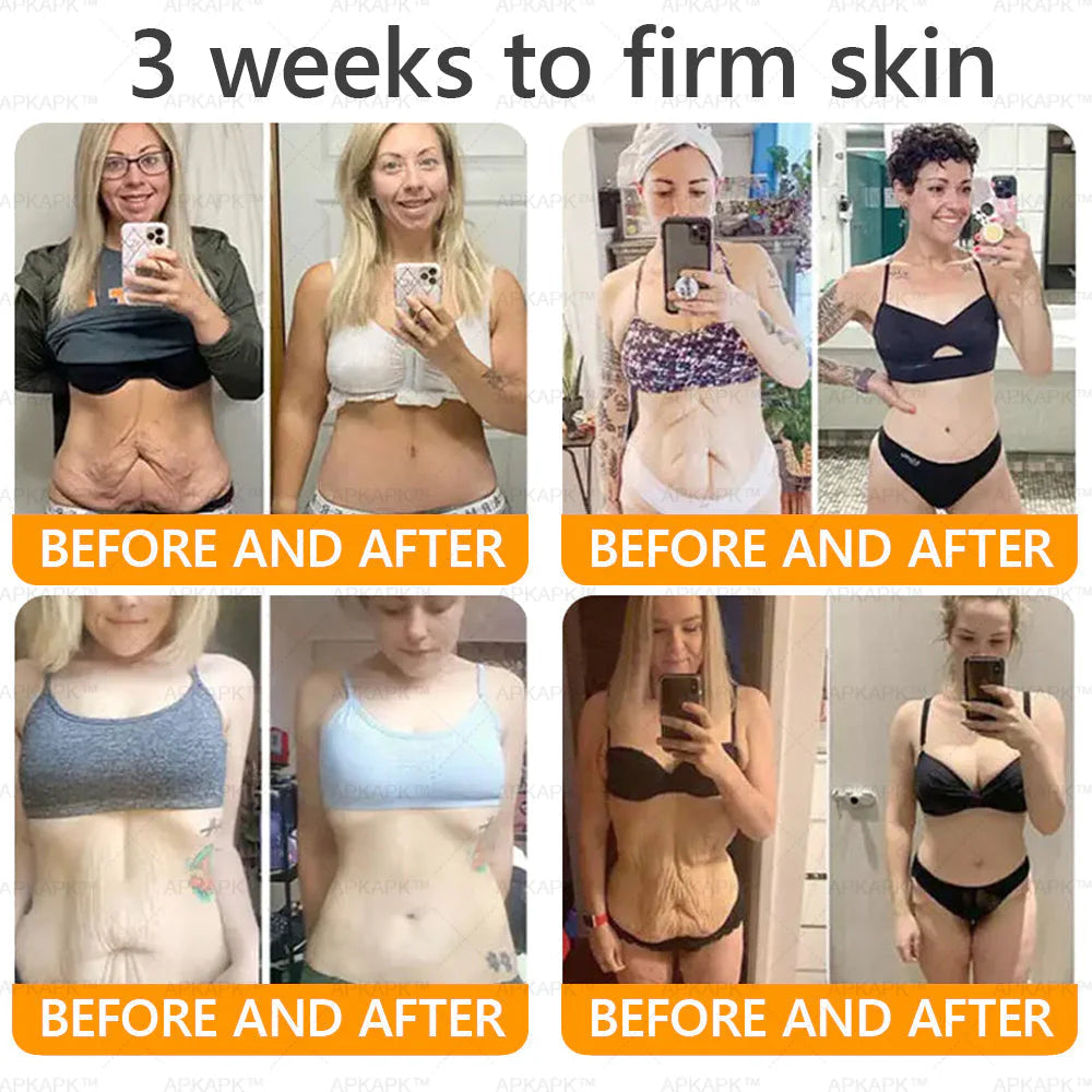 Bee Venom Comprehensive Anti-Aging Cream - Advanced Skin Firming and Wrinkle Repair