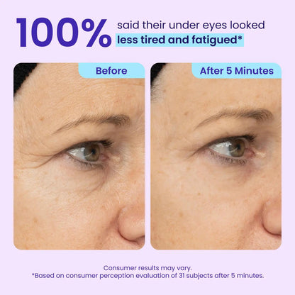 Instant Lift Eye Gel for Puffiness, Bags, Wrinkles, and Dark Circles - Anti-Aging Skin Care for Men & Women