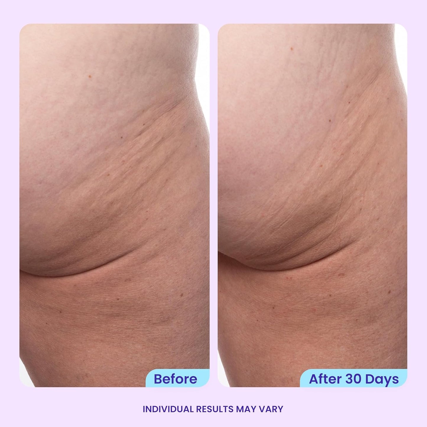 goPure Firming Butt & Thigh Cream - 8% MaxLift3 Complex