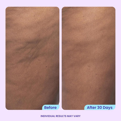 goPure Firming Butt & Thigh Cream - 8% MaxLift3 Complex
