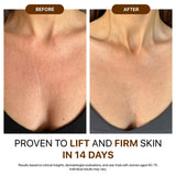 Silk Body Oil - Age-Defying Formula with 6 Essential Oils for Firming