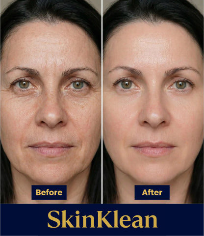 Peptide Deep Collagen Lifting Ampoule - Firming and Anti-Wrinkle Facial Serum