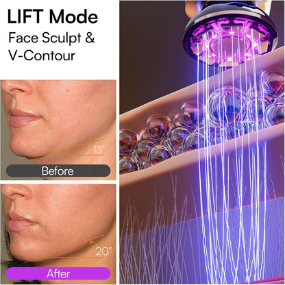 3-in-1 Red Light Therapy for Face and Neck, Skin Firming and Puffiness Skincare Tool (White)
