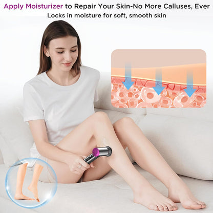 Electric Foot Callus Remover with Nano-Glass Head and Lotion Applicator