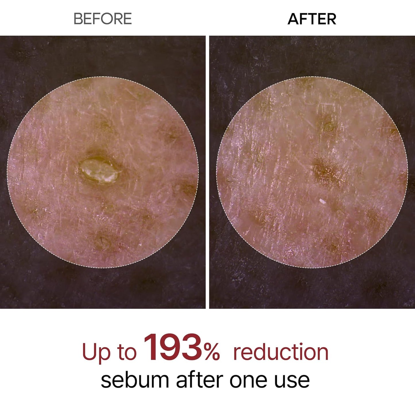 Dual-Action Rice Peel Ampoule & Scrub for Face and Body, Blackhead Remover