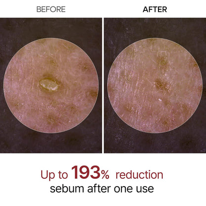 Dual-Action Rice Peel Ampoule & Scrub for Face and Body, Blackhead Remover