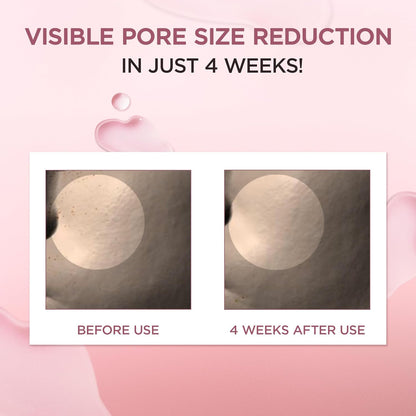 Madagascar Centella Poremizing Fresh Ampoule 3.38oz | Soothing Hydration for Oily & Combination Skin