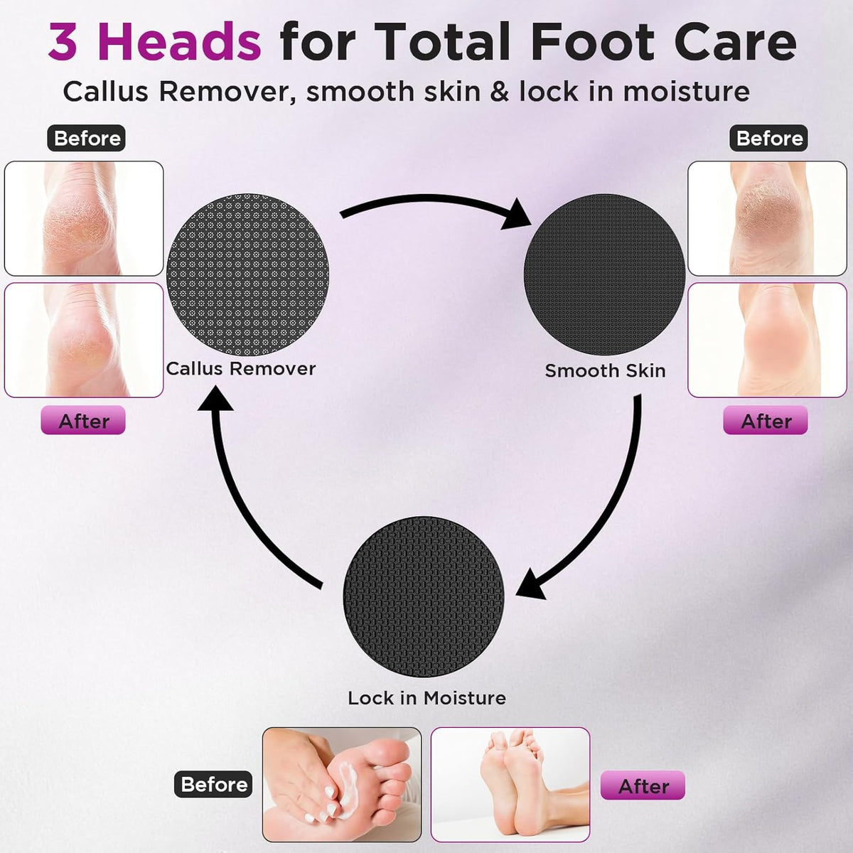 Electric Foot Callus Remover with Nano-Glass Head and Lotion Applicator