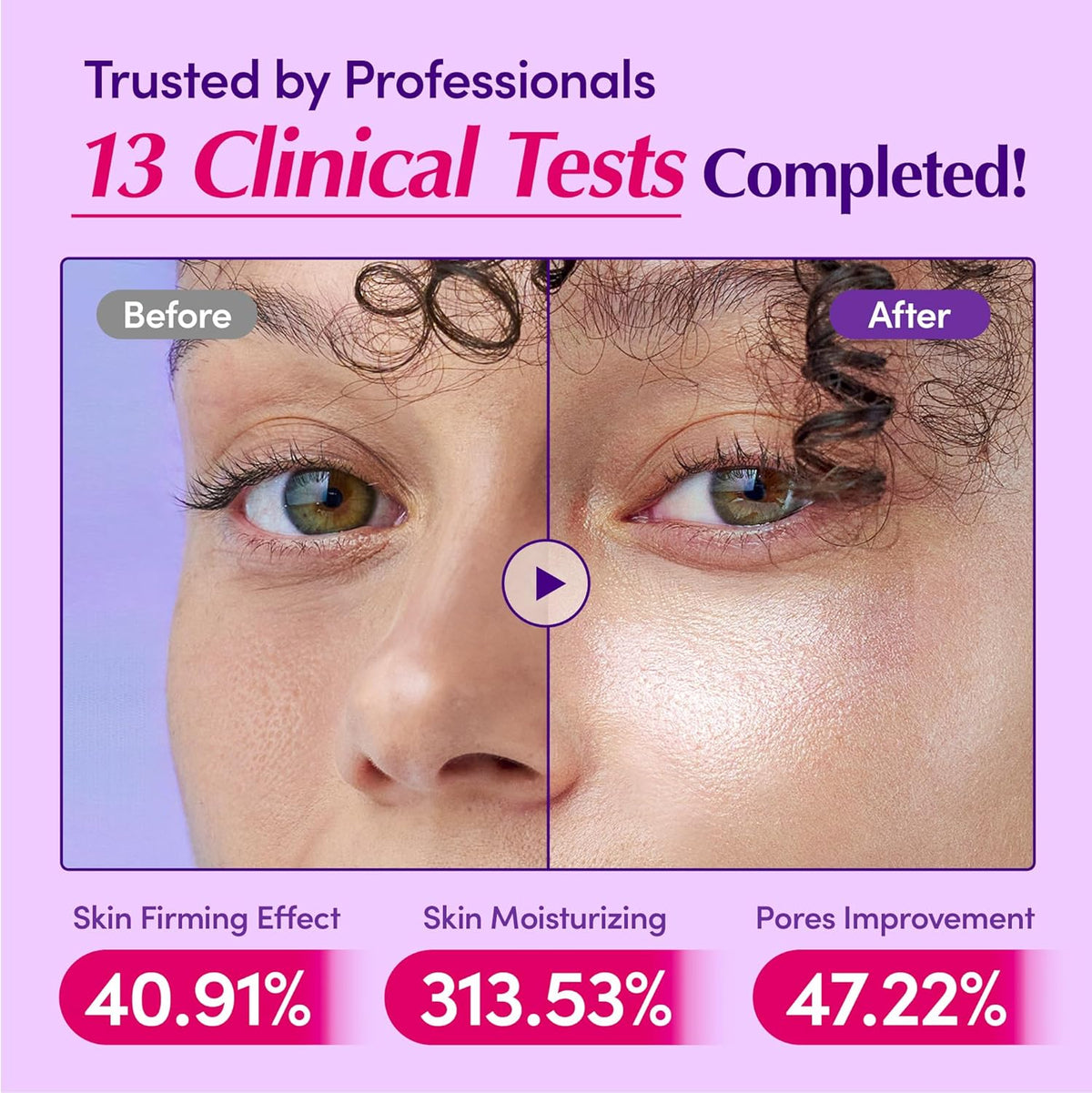 Bakuchiol Plumping Face Serum - Natural Retinol Alternative for Sensitive Skin with Niacinamide