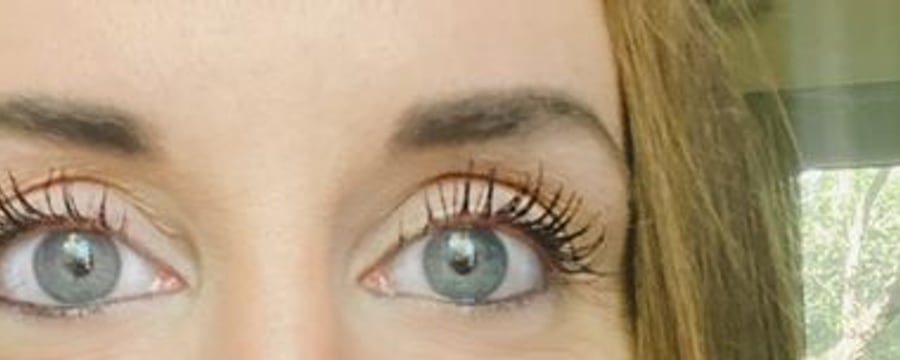 Customer photo focused on the eye area